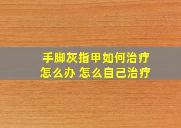 手脚灰指甲如何治疗怎么办 怎么自己治疗